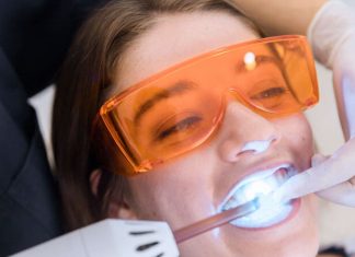 Ако сте планирали избељивање зуба ево где тренутно можете остварити попуст! Izbeljivanje zuba